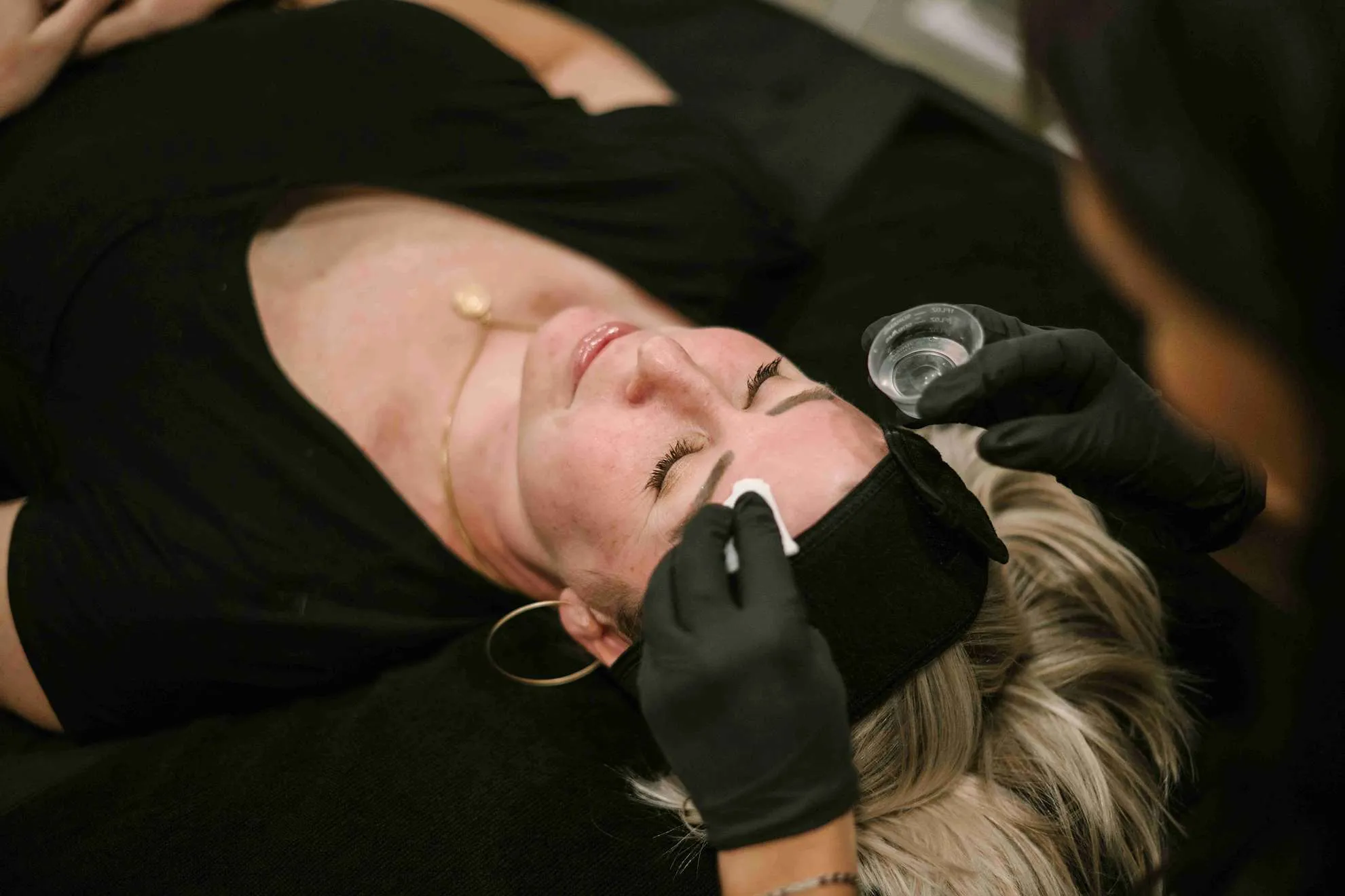 Chemical peel performed by Aesthetician | Arabella Medical Aesthetics | Knoxville, TX