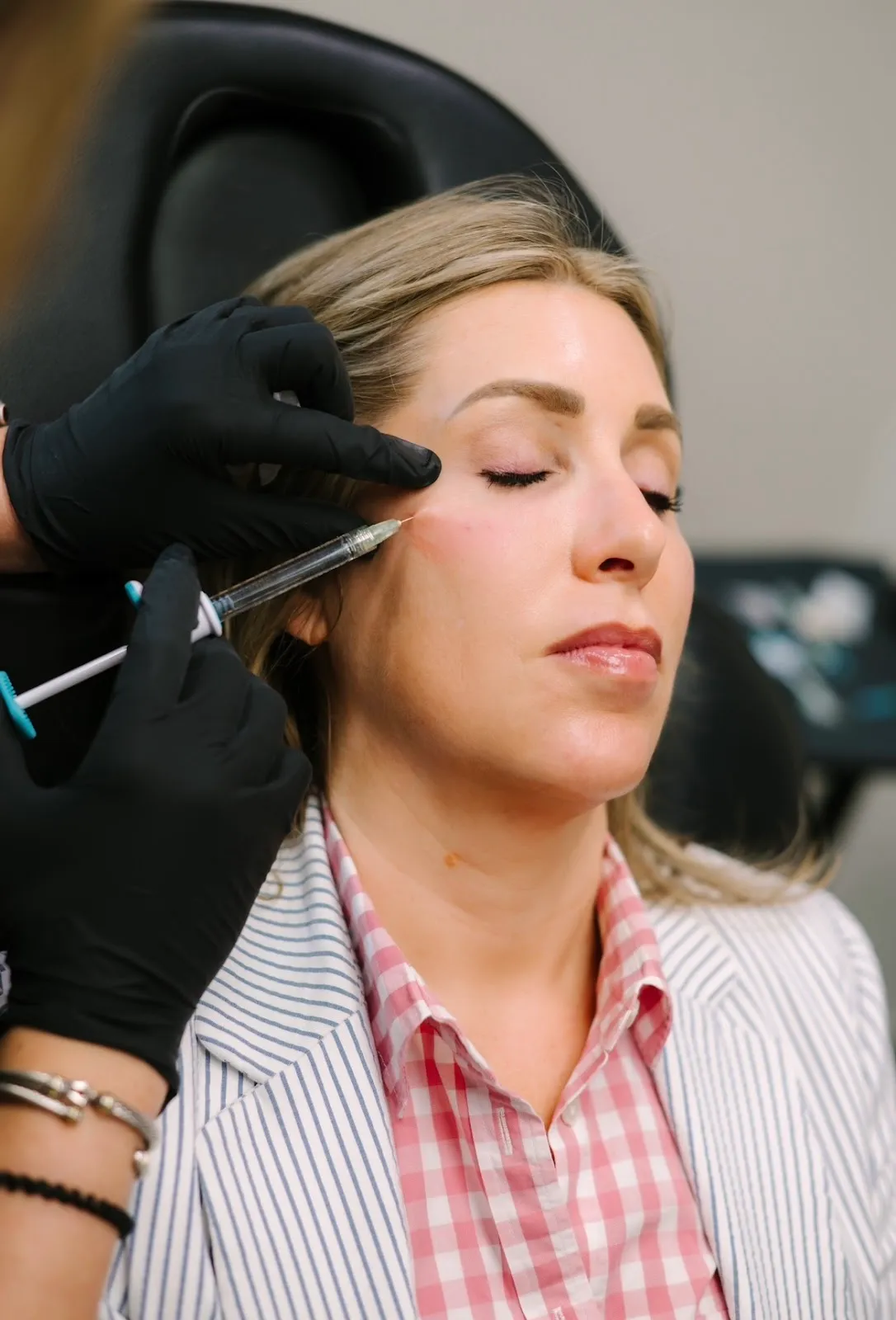 SkinVive Treatment given on cheeks | Arabella Medical Aesthetics | Knoxville, TX