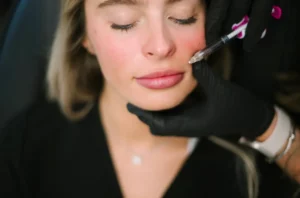 Lip Filler in Knoxville, TX | Arabella Medical Aesthetics