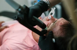 RF Microneedling Treatment Arabella Medical Aesthetics in Knoxville, TX
